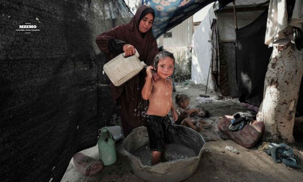 Gazas-Disease-Crisis-How-Hunger-Filth-and-Siege-Are-Burning-Childrens-Skin