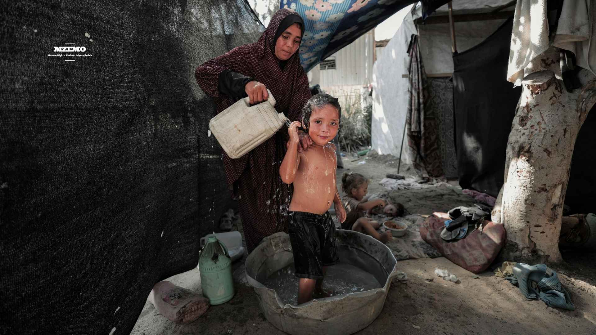 Gazas-Disease-Crisis-How-Hunger-Filth-and-Siege-Are-Burning-Childrens-Skin